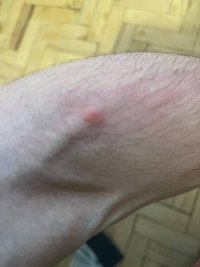 hand1.jpg